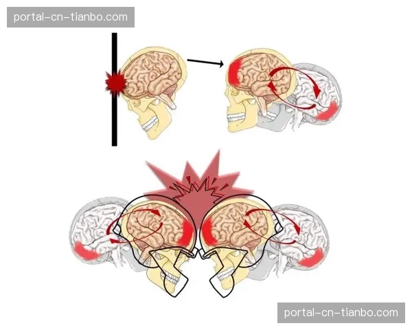 学术期刊《运动医学》发布研究:综合格斗运动员脑震荡长期风险低于美式足球 学术期刊《运动医学》发布研究:综合格斗运动员脑震荡长期风险低于美式足球